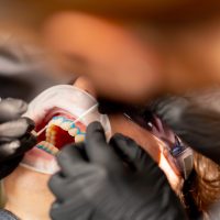 NHA KHOA TỔNG QUÁT